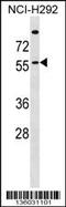 Zinc Finger DHHC-Type Containing 13 antibody, 58-545, ProSci, Western Blot image 
