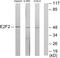 E2F Transcription Factor 2 antibody, LS-C119036, Lifespan Biosciences, Western Blot image 