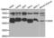 Chromobox 8 antibody, LS-C334571, Lifespan Biosciences, Western Blot image 