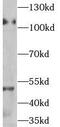 Nuclear factor NF-kappa-B p100 subunit antibody, FNab05707, FineTest, Western Blot image 