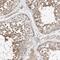 Chromosome 6 Open Reading Frame 118 antibody, HPA029789, Atlas Antibodies, Immunohistochemistry frozen image 