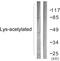 Acetylated-Lysine antibody, LS-C120523, Lifespan Biosciences, Western Blot image 