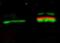 Protein kinase B antibody, TA319277, Origene, Western Blot image 