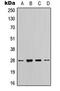 Tyrosine 3-Monooxygenase/Tryptophan 5-Monooxygenase Activation Protein Zeta antibody, MBS8239404, MyBioSource, Western Blot image 