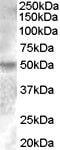 Estrogen Related Receptor Gamma antibody, PA5-18889, Invitrogen Antibodies, Western Blot image 