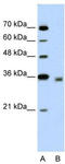 2,4-Dienoyl-CoA Reductase 2 antibody, TA331825, Origene, Western Blot image 