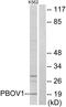 Prostate And Breast Cancer Overexpressed 1 antibody, GTX87880, GeneTex, Western Blot image 