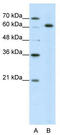 Small Nuclear Ribonucleoprotein U1 Subunit 70 antibody, TA345725, Origene, Western Blot image 