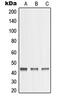 Matrix Metallopeptidase 23B antibody, MBS821563, MyBioSource, Western Blot image 