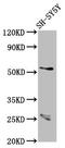Cerebellar degeneration-related protein 2-like antibody, LS-C671831, Lifespan Biosciences, Western Blot image 