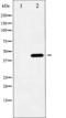 SMAD Family Member 3 antibody, TA325853, Origene, Western Blot image 
