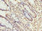 UDP Glycosyltransferase Family 3 Member A2 antibody, LS-C676683, Lifespan Biosciences, Immunohistochemistry paraffin image 