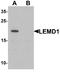 LEM Domain Containing 1 antibody, A16257, Boster Biological Technology, Western Blot image 
