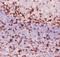 CD3 antibody, LS-C343957, Lifespan Biosciences, Immunohistochemistry paraffin image 