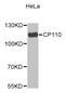 Centrosomal protein CP110 antibody, MBS128757, MyBioSource, Western Blot image 
