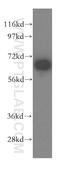 Melanoma-associated antigen D2 antibody, 15252-1-AP, Proteintech Group, Western Blot image 