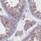 Prolyl-TRNA Synthetase 2, Mitochondrial antibody, HPA028518, Atlas Antibodies, Immunohistochemistry paraffin image 
