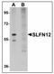 Schlafen Family Member 12 antibody, AP23570PU-N, Origene, Western Blot image 