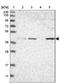Acyl-CoA Dehydrogenase Medium Chain antibody, NBP1-89293, Novus Biologicals, Western Blot image 