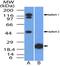 NUT Midline Carcinoma Family Member 1 antibody, NBP2-31146, Novus Biologicals, Western Blot image 