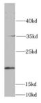 S-Phase Kinase Associated Protein 1 antibody, FNab07897, FineTest, Western Blot image 