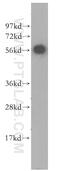 LP antibody, 11551-1-AP, Proteintech Group, Western Blot image 