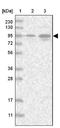 Von Willebrand Factor A Domain Containing 3B antibody, NBP2-38320, Novus Biologicals, Western Blot image 