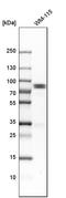 Holliday junction recognition protein antibody, HPA008436, Atlas Antibodies, Western Blot image 