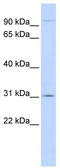 MutS Homolog 5 antibody, TA346022, Origene, Western Blot image 