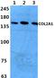PC2 antibody, AP06068PU-N, Origene, Western Blot image 
