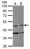 Family With Sequence Similarity 98 Member B antibody, PA5-32102, Invitrogen Antibodies, Western Blot image 