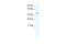 Farnesoid X receptor beta splice variant 5 antibody, 28-709, ProSci, Western Blot image 