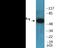 Peroxisome Proliferator Activated Receptor Gamma antibody, EKC2111, Boster Biological Technology, Western Blot image 