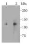 Integrin Subunit Alpha V antibody, A01561-1, Boster Biological Technology, Western Blot image 