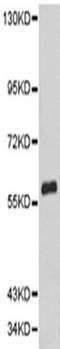 Cyclin Dependent Kinase Inhibitor 1C antibody, TA323745, Origene, Western Blot image 