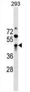 Zinc finger and BTB domain-containing protein 32 antibody, AP54611PU-N, Origene, Western Blot image 