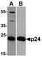 GAG antibody, TA160044, Origene, Western Blot image 