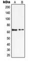 Protein Inhibitor Of Activated STAT 2 antibody, LS-C353122, Lifespan Biosciences, Western Blot image 