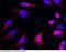 Hexokinase-1 antibody, 101347-T38, Sino Biological, Immunohistochemistry paraffin image 