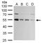 Cysteine protease ATG4C antibody, GTX129488, GeneTex, Western Blot image 