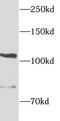 Integrin Subunit Alpha E antibody, FNab09901, FineTest, Western Blot image 