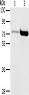 Protein Inhibitor Of Activated STAT 1 antibody, TA350894, Origene, Western Blot image 