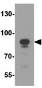 Lin-54 DREAM MuvB Core Complex Component antibody, GTX31591, GeneTex, Western Blot image 