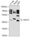Alcohol Dehydrogenase 1C (Class I), Gamma Polypeptide antibody, 23-387, ProSci, Western Blot image 