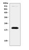 Olfactory Marker Protein antibody, A01781, Boster Biological Technology, Western Blot image 