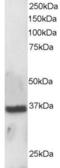 Krueppel-like factor 16 antibody, orb18392, Biorbyt, Western Blot image 