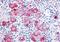 Epoxide Hydrolase 2 antibody, orb87564, Biorbyt, Immunohistochemistry paraffin image 