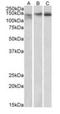 Cohesin subunit SA-2 antibody, orb20351, Biorbyt, Western Blot image 