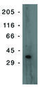 Tumor Protein P53 Inducible Protein 3 antibody, MBS395169, MyBioSource, Western Blot image 
