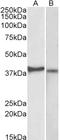 C-X3-C Motif Chemokine Receptor 1 antibody, TA341380, Origene, Western Blot image 